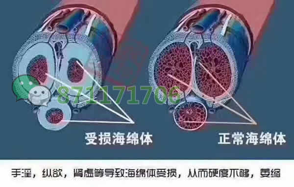 阴茎海绵体损伤怎么办